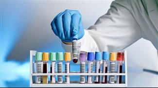 פענוח בדיקות דם - תפקודי כליה