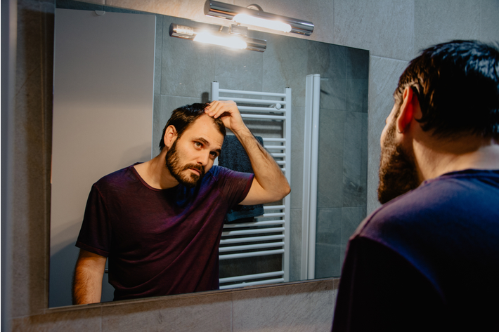 גבר צעיר בוחן את המפרצים בשיער ושוקל השתלת שיער 