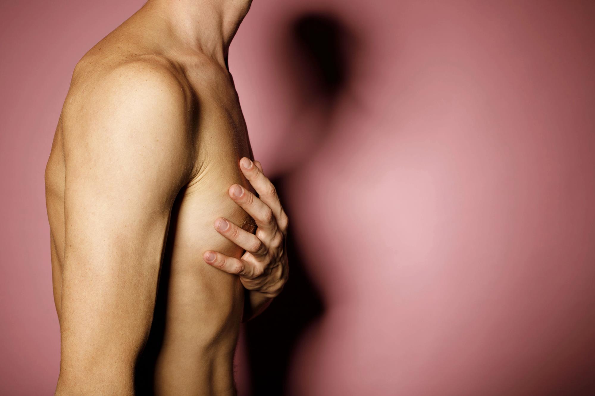 אילוסטרציה - גבר עם גניקומסטיה , חזה גברי בעל מראה נשי