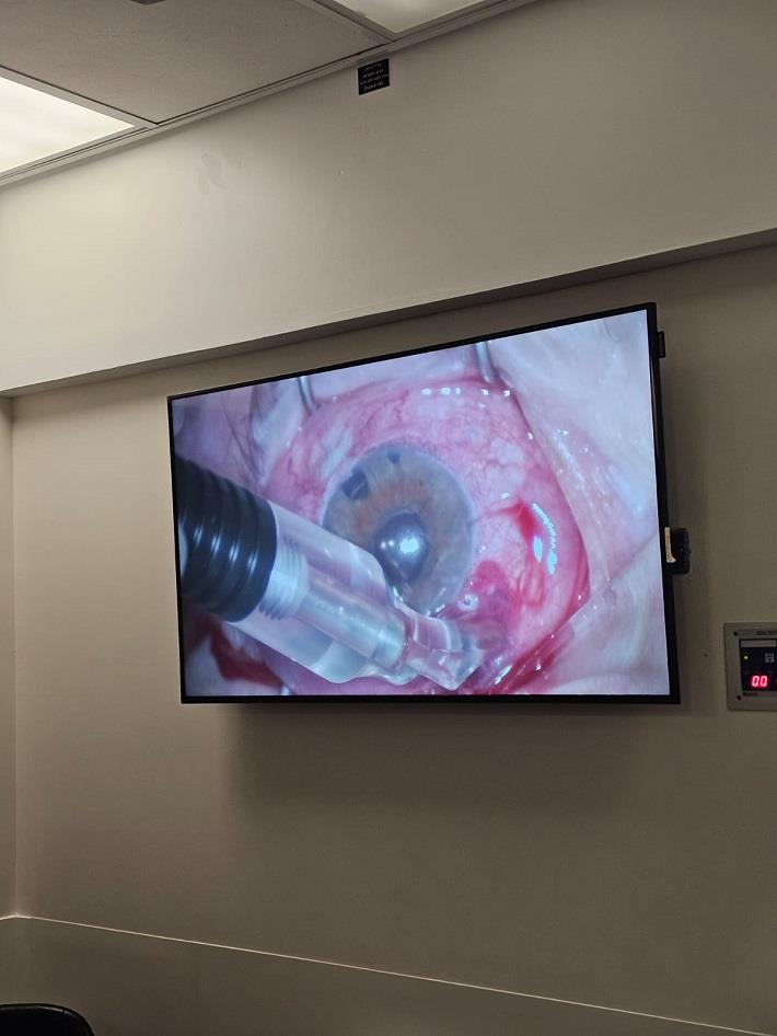 ניתוח CPC במרכז עין טל