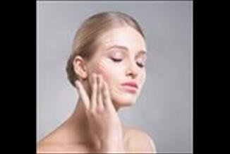 הרמת פנים - לחזור להיראות צעיר