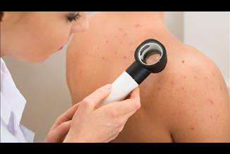 סובלים מנגעים בעור? בדקו האם מגיע לכם פיצוי