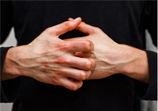 האביב כבר כאן, ואיתו האלרגיות: האם השנה זה באמת גרוע יותר?